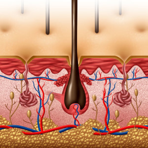 l'alopecia